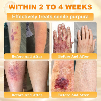 【𝟐𝟎𝟐𝟔 𝐍𝐞𝐰 𝐔𝐩𝐠𝐫𝐚𝐝𝐞: 𝟖𝟎% 𝐎𝐅𝐅】📎🍯Aeehfeng® Bee Venom Skin Restoration Cream – with Royal Jelly, Hyaluronic Acid and Bee Venom for skin hydration, elasticity, anti-aging & repair